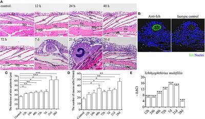 The Change of Teleost Skin Commensal Microbiota Is Associated With Skin Mucosal Transcriptomic Responses During Parasitic Infection by Ichthyophthirius multifillis